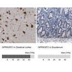 GPRASP2 Antibody in Immunohistochemistry (IHC)