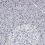 ATCAY Antibody in Immunohistochemistry (IHC)