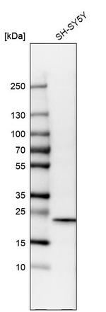 Cytoglobin Antibody in Western Blot (WB)