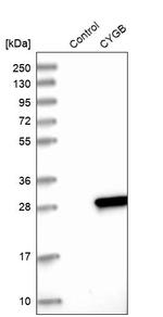 Cytoglobin Antibody in Western Blot (WB)