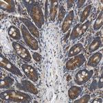 SLC36A4 Antibody in Immunohistochemistry (IHC)