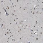 NUP93 Antibody in Immunohistochemistry (IHC)