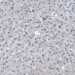 NUP93 Antibody in Immunohistochemistry (IHC)