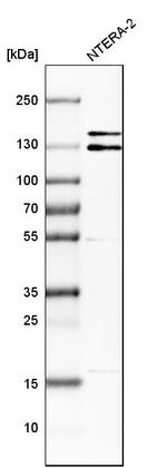 ITSN1 Antibody in Western Blot (WB)