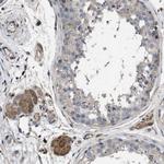 SQLE Antibody in Immunohistochemistry (IHC)