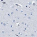 NKCC2 Antibody in Immunohistochemistry (IHC)