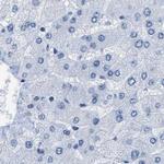 NKCC2 Antibody in Immunohistochemistry (IHC)