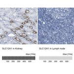 NKCC2 Antibody