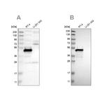 TES Antibody in Western Blot (WB)