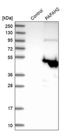 PAFAH2 Antibody in Western Blot (WB)