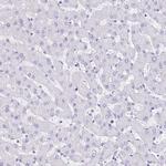 GUCA2A Antibody in Immunohistochemistry (IHC)