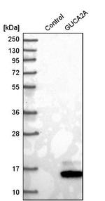 GUCA2A Antibody in Western Blot (WB)