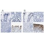 UPK3A Antibody in Immunohistochemistry (IHC)