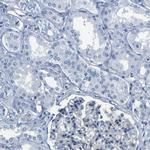 UPK3A Antibody in Immunohistochemistry (IHC)