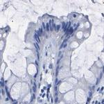 UPK3A Antibody in Immunohistochemistry (IHC)