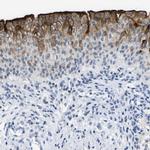 UPK3A Antibody in Immunohistochemistry (IHC)