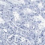 UPK3A Antibody in Immunohistochemistry (IHC)