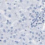 UPK3A Antibody in Immunohistochemistry (IHC)