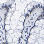 UPK3A Antibody in Immunohistochemistry (IHC)