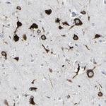 G3BP2 Antibody in Immunohistochemistry (IHC)