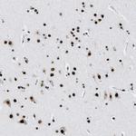 LUC7L3 Antibody in Immunohistochemistry (IHC)