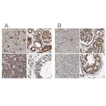 BAG3 Antibody in Immunohistochemistry (IHC)