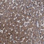 BAG3 Antibody in Immunohistochemistry (IHC)