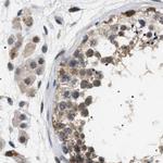 BAG3 Antibody in Immunohistochemistry (IHC)