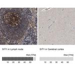 SIT Antibody in Immunohistochemistry (IHC)