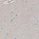 SIT Antibody in Immunohistochemistry (IHC)