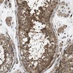 CHKB Antibody in Immunohistochemistry (IHC)