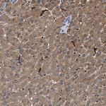 GCN1L1 Antibody in Immunohistochemistry (IHC)