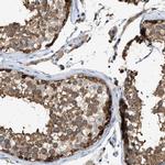 GCN1L1 Antibody in Immunohistochemistry (IHC)