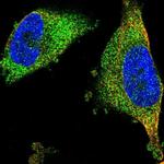 FNTA Antibody in Immunocytochemistry (ICC/IF)