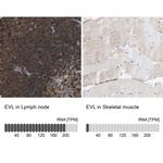 EVL Antibody in Immunohistochemistry (IHC)