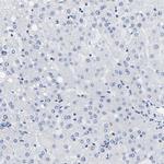 A33 Antibody in Immunohistochemistry (IHC)