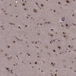 SF1 Antibody in Immunohistochemistry (IHC)