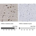 YARS Antibody in Immunohistochemistry (IHC)