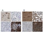 YARS Antibody in Immunohistochemistry (IHC)