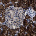 YARS Antibody in Immunohistochemistry (IHC)