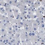 YARS Antibody in Immunohistochemistry (IHC)