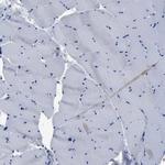 YARS Antibody in Immunohistochemistry (IHC)