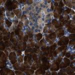 YARS Antibody in Immunohistochemistry (IHC)