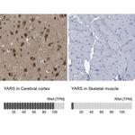 YARS Antibody