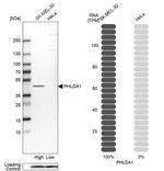 PHLDA1 Antibody