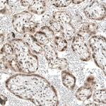 TET1 Antibody in Immunohistochemistry (IHC)