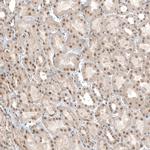 TET1 Antibody in Immunohistochemistry (IHC)