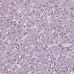 XK Antibody in Immunohistochemistry (IHC)