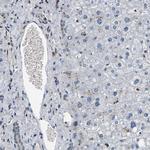 RBM28 Antibody in Immunohistochemistry (IHC)