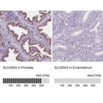 Prostein Antibody in Immunohistochemistry (IHC)